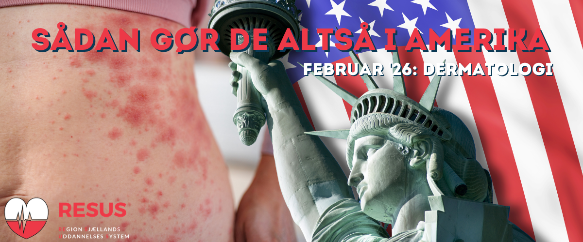 Sådan gør de altså i Amerika - Februar 2026